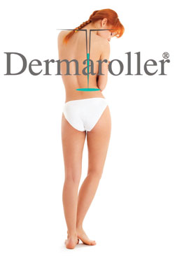 Dermaroller Treatment Richmond Hill